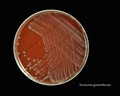 Neisseria gonorrhoeae